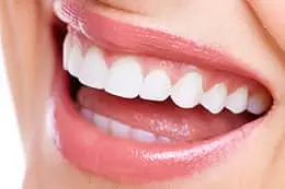審美歯科で白く綺麗になった歯